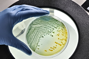 Food bacteria